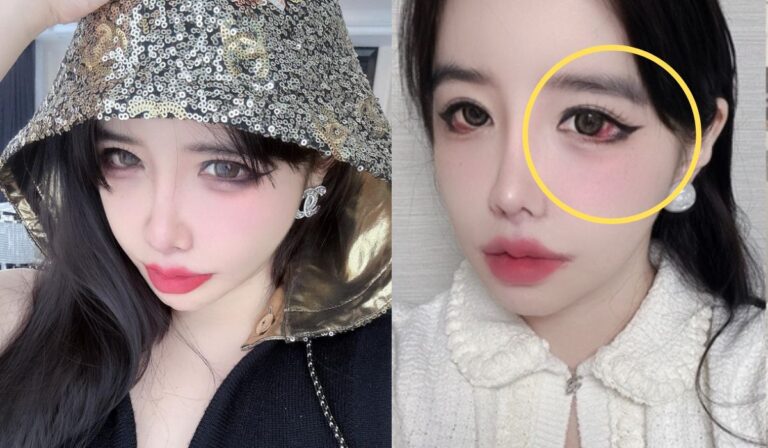 Famous Kpop Idol Worries Fans With Selfie Showing Bloodshot Eyes