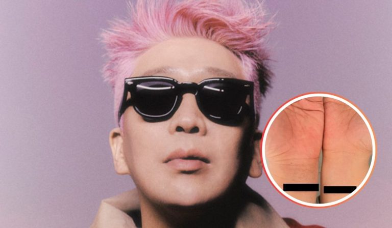 MC Mong Causes Shock Sharing Photo Of Self-Harm And Talking About His Recent Suicide Attempt
