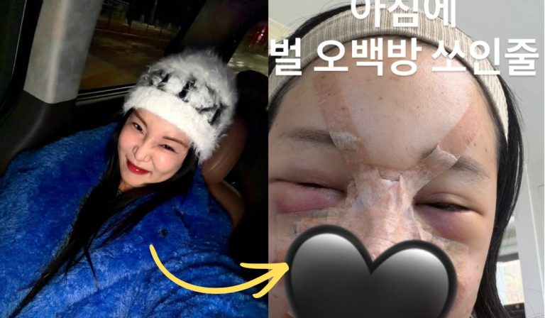 Popular Korean YouTuber Shares Shocking Update After Undergoing Several Plastic Surgeries