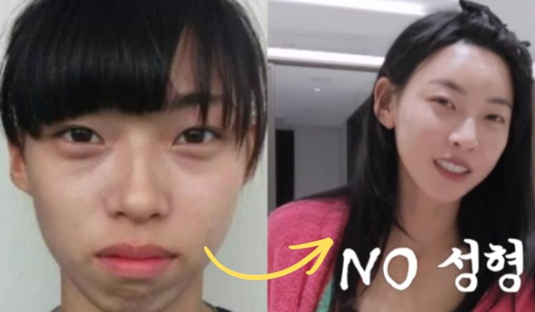 “Single’s Inferno 5” Contestant Kim Min Ji Denies Plastic Surgery Rumors But Admits To Getting Veneers, Botox And Fillers